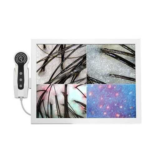 Hair Analyzer - Color: All