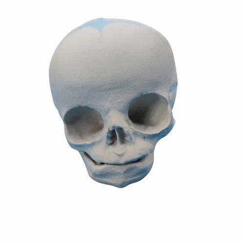 Skull Model - Application: Kite 121