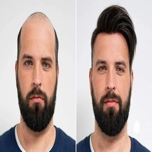 Wig For Men - Color: All