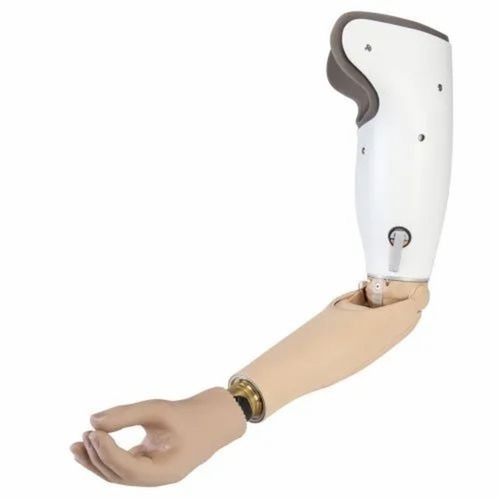 Above Elbow Hand Prosthesis