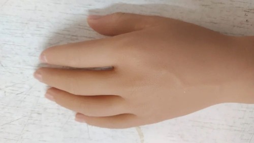Silicon Finger Prosthesis