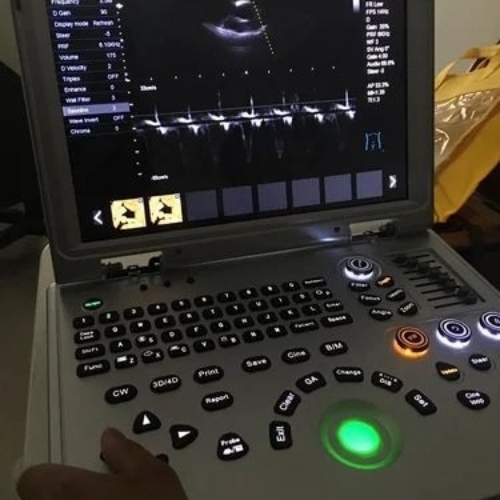 High Megahertz USG Ultrasound Machine