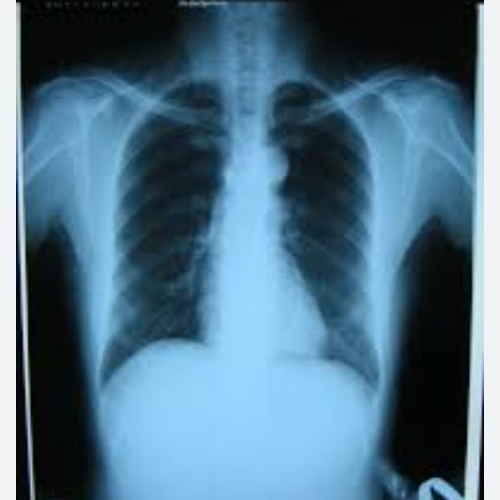 Xray film