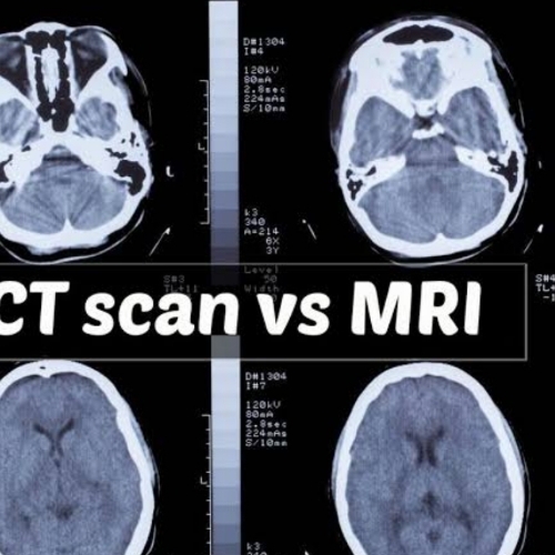 MRI ct