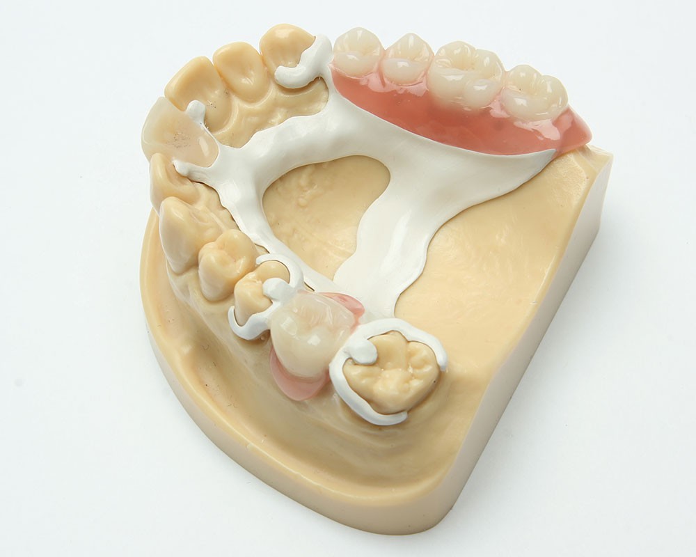 Direct Service To Dental Clinics From China, Denture Lab In China By Shenzhen Jiusheng denture Technology Co., LTD