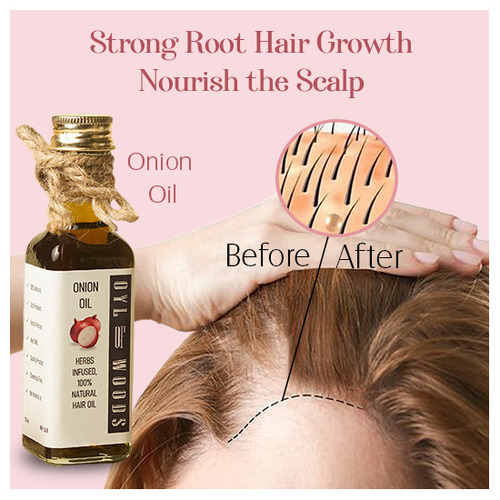 Onion Hair Oil