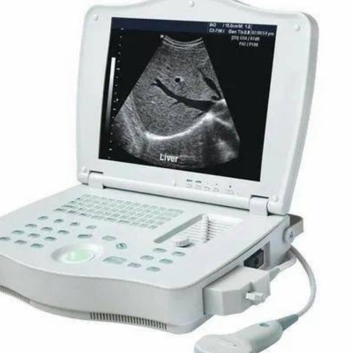 Ultra Sound Scanner