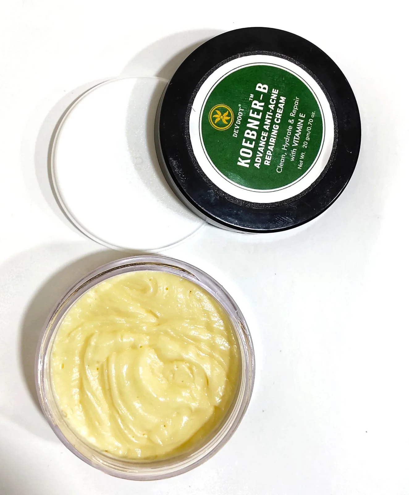 Koebner-B Anti Acne Cream 20gm