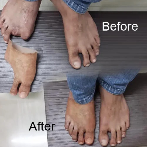 Prosthesis Foot - Attributes: .