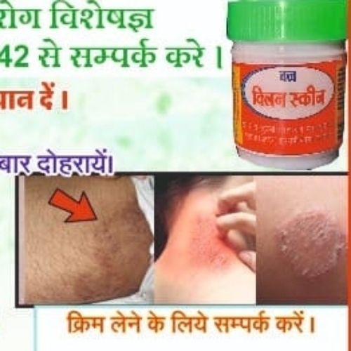 Anti Fungal Cream