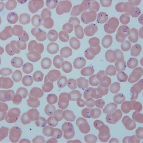 Diagnosis of malaria parasite with floron 