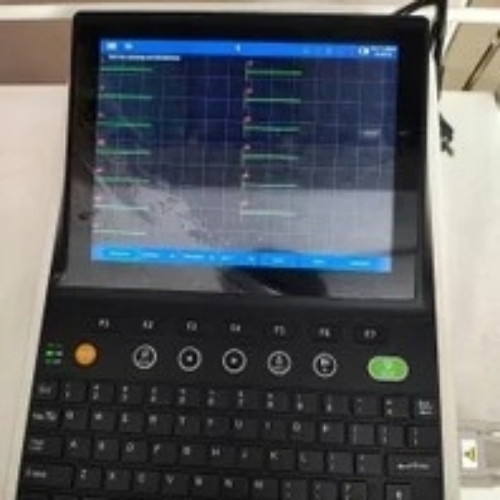 ECG Monitor