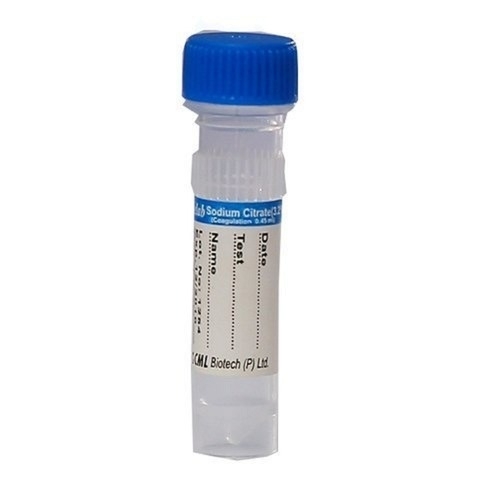Sodium Citrate Tube