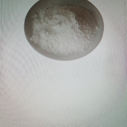 Nicorandil tablet 5mg