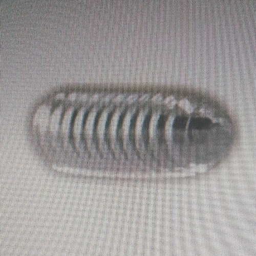ACL Bioavailable screw