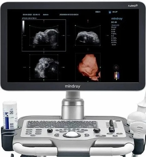 Mindray 4d Ultrasound Machine - Metal, Standard Size, White, 3 Connectivity Ports, Convex, Phased Array, Linear Array Probes, 21.5" Monitor | DICOM, Wireless LAN, 1024x985 Resolution, Electric Powered