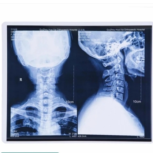 Mri Dry Inkjet X Ray Film