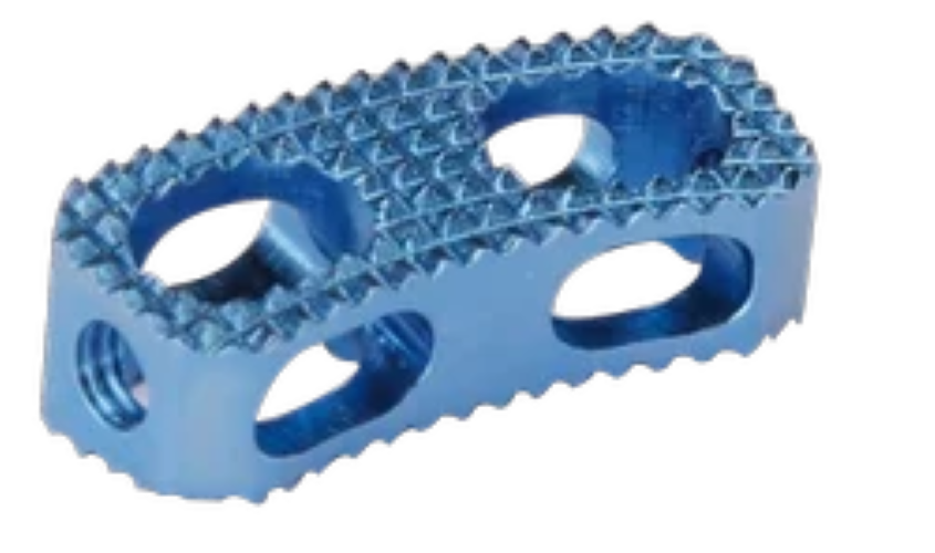 Orthopedic Cervical Cage - PEEK Implant, Porous Design | Sterile, Durable, Spinal Fusion Support