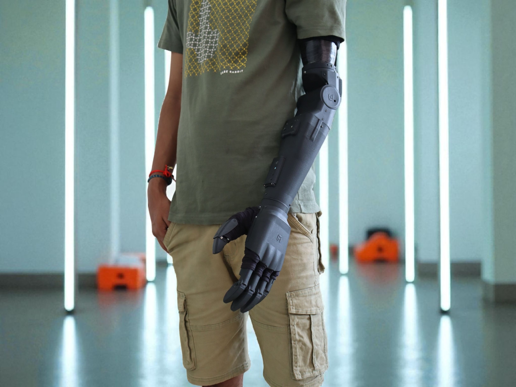 Prosthetic Elbow Joint