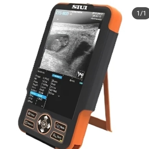 Ultrasound Scanner