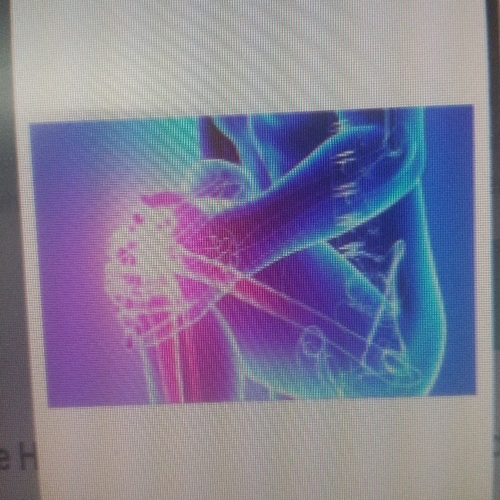 Orthopedic