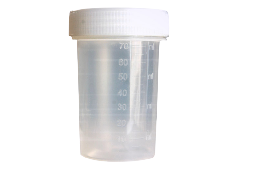 Urine Collection Bottle
