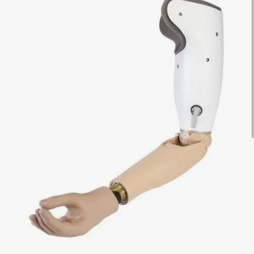 Upper Limb Prosthetic