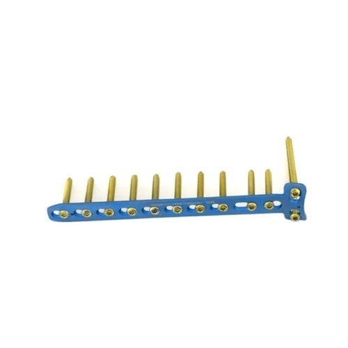 Buttress Locking Plate