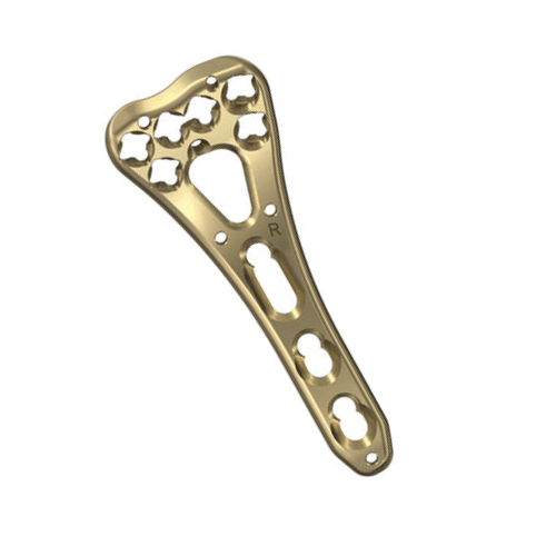 Two Column Distal Radius Plate Volar - Titanium, Narrow 6 Holes, Golden | Anatomical Fit, Variable Angle Locking