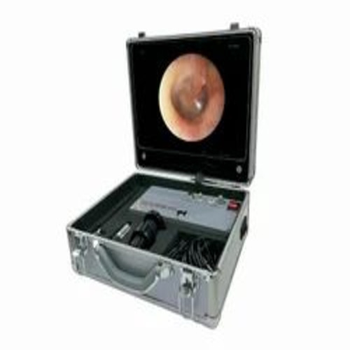 Portable Endoscopy Unit