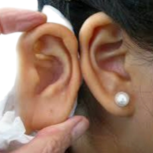 Silicone Ear
