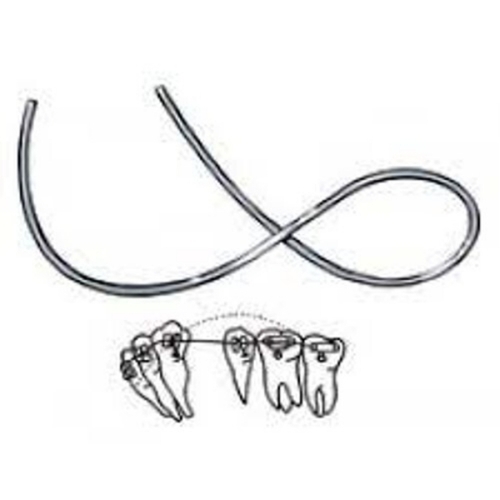 Orthodontic Niti Wires