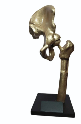 3d Print Hip Joint Replacement Model
