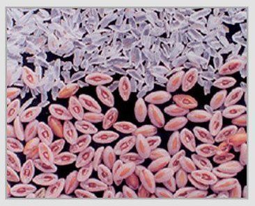 Psyllium Seed (Plantago Ovata Forsk)