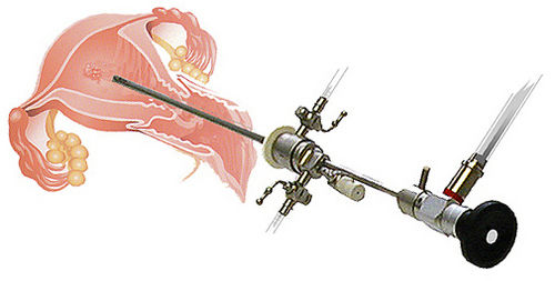 Gynecological Surgery Set