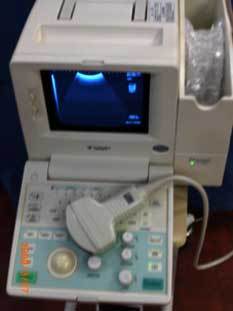 SSD 5500 Ultrasound