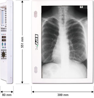 Medical Panel Pc