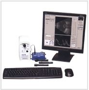 Ophthalmic B and A-Scan Ultrasound System