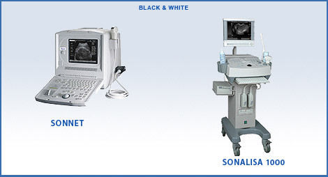  अल्ट्रासाउंड ब्लैक एंड व्हाइट