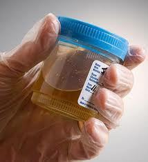 Urine Diseases Medicine