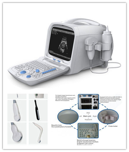 Portable Ultrasound Machine