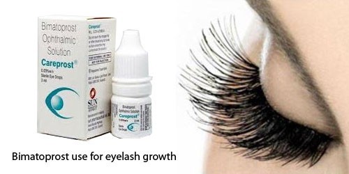 Careprost Eye Drops Application: Hotels