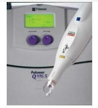 Palomar Q-Yag 5 Laser Tattoo Removal System By Star Medical Indo