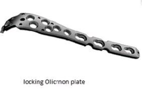 Locking Olecranon Plate