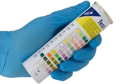 Plastic Urine Reagent Test Strips - 10 Parameter