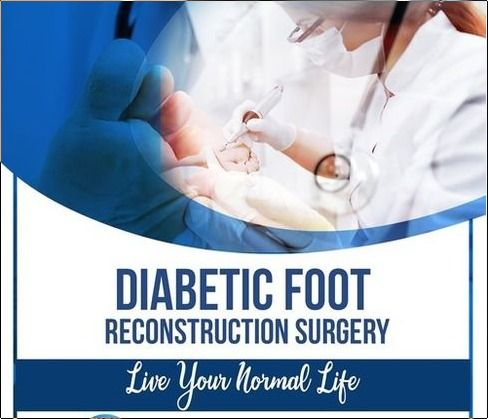 Diabetic Foot Reconstruction Surgery Services By MADURAI FOOT CARE CENTRE