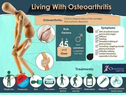 Osteoarthritis Treatment Services