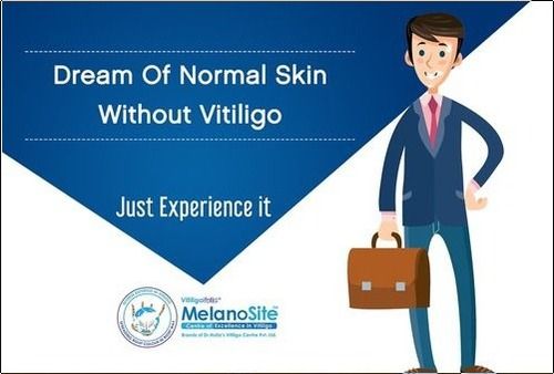 Vitiligo Treatment Services By MelanoSite - Centre of Excellence in Vitiligo