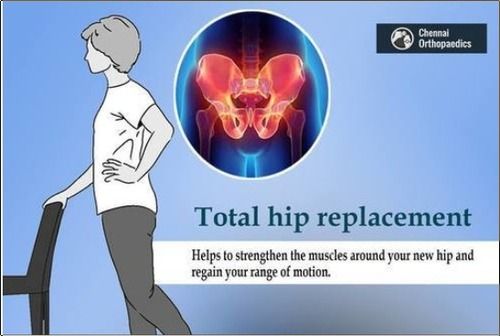 Hip Replacement Services