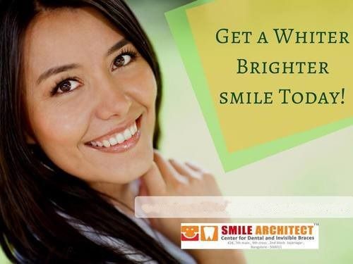 Laser Teeth Whitening Treatment Services By Smile Architect